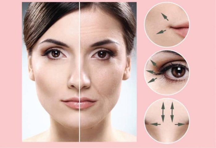 نتاییج قبل و بعد استفاده از دستگاه آر اف فرکشنال سوزنی